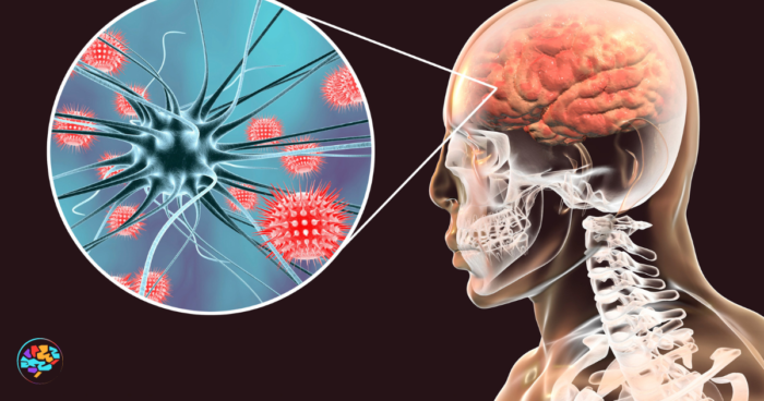 ¿Qué es la Encefalitis? Causas y Síntomas de esta Enfermedad Neurológica